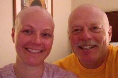 Rochester-Beth-and-Dad-Bald-Heads